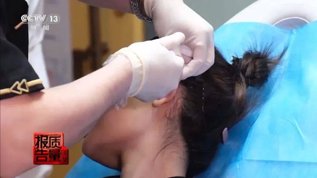 一针下去“美容”变“毁容” 记者调查医美注射乱象